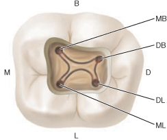 Molar inferior