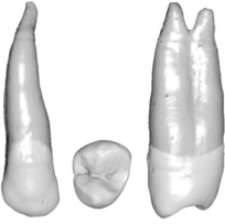 Premolar superior