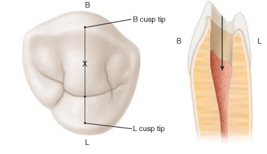 Premolar inferior