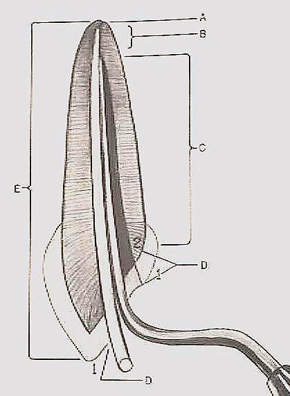 Preparación radicular