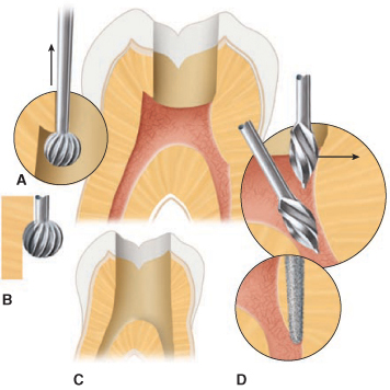 compensatorio