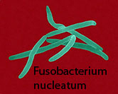 Fusobacterium nucleatum