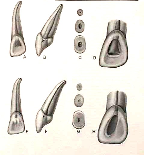 Incisivo lateral superior